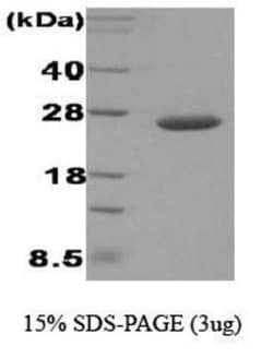 Novus Biologicals&trade;&nbsp;Recombinant E. coli Disulfide-bond isomerase Protein