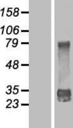 Novus Biologicals&trade;&nbsp;DjC9 Overexpression Lysate