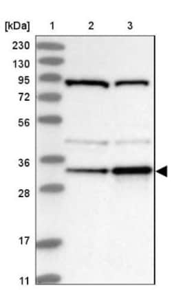 DjC9 Antibody, Novus Biologicals 0.1mL; Unlabeled:Antibodies, Polyclonal