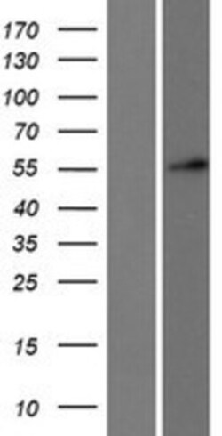 Novus Biologicals&trade;&nbsp;DKC1 Overexpression Lysate