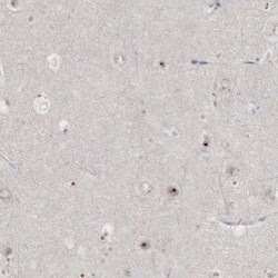 DKC1 Antibody, Novus Biologicals 0.1mL; Unlabeled:Antibodies, Polyclonal