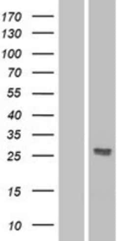 Novus Biologicals&trade;&nbsp;Dkk-2 Overexpression Lysate