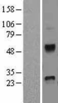 Novus Biologicals&trade;&nbsp;Dkk-4 Overexpression Lysate
