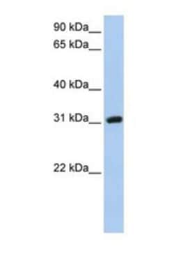 Soggy-1/DkkL1 Antibody, Novus Biologicals 0.05mg; Unlabeled:Antibodies,