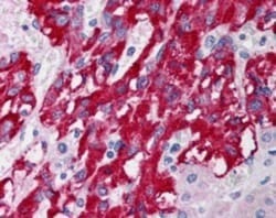 DLC1 Antibody - Isoform 1 and 3, Novus Biologicals 0.1mg; Unlabeled:Antibodies,
