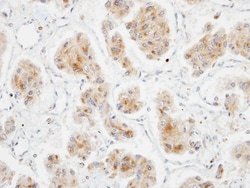 DLC1 Antibody, Novus Biologicals 0.1mL; Unlabeled:Antibodies, Polyclonal