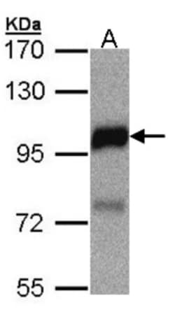 DLC1 Antibody, Novus Biologicals 0.1mL; Unlabeled:Antibodies, Polyclonal