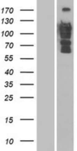 Novus Biologicals™ DLC1 Overexpression Lysate