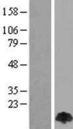 Novus Biologicals™ PIN/DLC8 Overexpression Lysate