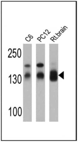 DLG1 Antibody, Novus Biologicals 0.025 mL, Unconjugated:Antibodies, Polyclonal