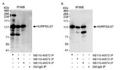 DLG7/HURP Antibody, Novus Biologicals 0.1mg; Unlabeled:Antibodies, Polyclonal