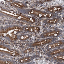 DLGAP2 Antibody, Novus Biologicals:Antibodies:Primary Antibodies