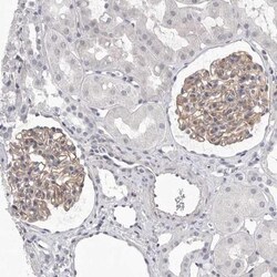 DLGAP3 Antibody, Novus Biologicals 0.1mL; Unlabeled:Antibodies, Polyclonal