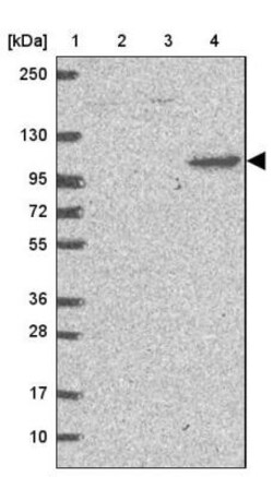 DLGAP4 Antibody, Novus Biologicals 0.1mL; Unlabeled:Antibodies, Polyclonal
