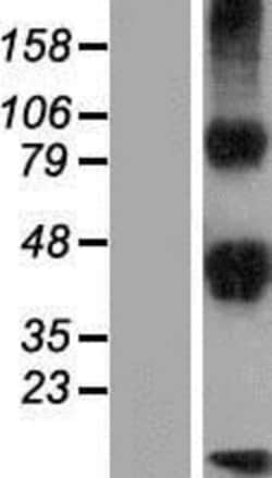 Novus Biologicals&trade;&nbsp;DLK2/EGFL9 Overexpression Lysate