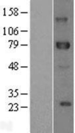 Novus Biologicals&trade;&nbsp;DLL1 Overexpression Lysate
