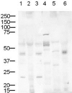 DLL1 Antibody, Novus Biologicals 0.1mg; Unlabeled:Antibodies, Polyclonal