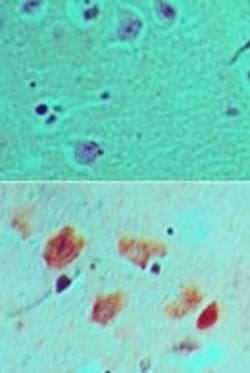 DLL3 Antibody, Novus Biologicals 0.1mg; Unlabeled:Antibodies, Polyclonal