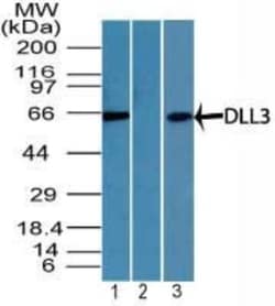 DLL3 Antibody, Novus Biologicals 0.1mg; Unlabeled:Antibodies, Polyclonal