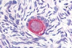DLL4 Antibody, Novus Biologicals 0.1mg; Unlabeled:Antibodies, Polyclonal