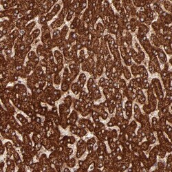 DLST Antibody, Novus Biologicals 0.1mL; Unlabeled:Antibodies, Polyclonal