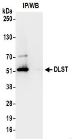 DLST Antibody, Novus Biologicals 0.1mg; Unlabeled:Antibodies, Polyclonal