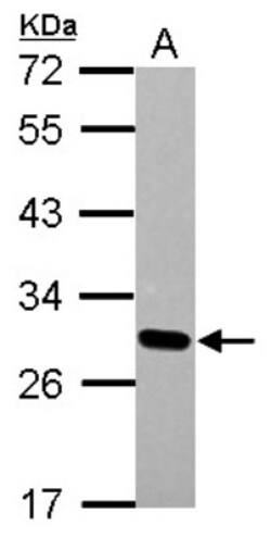 Dlx1 Antibody, Novus Biologicals 0.1mL; Unlabeled:Antibodies, Polyclonal