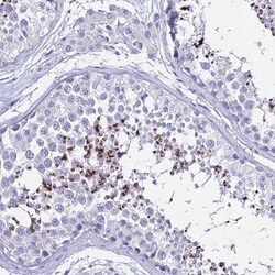 Dlx1 Antibody, Novus Biologicals 25 &mu;L, Unconjugated:Antibodies, Polyclonal