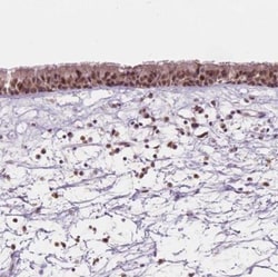 Dlx6 Antibody, Novus Biologicals 25 &mu;L; Unlabeled:Antibodies, Polyclonal