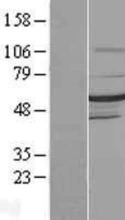 Novus Biologicals™ DMAP1 Overexpression Lysate