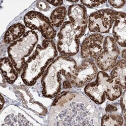 DMGDH Antibody, Novus Biologicals 25 &mu;L | Buy Online | Novus Biologicals | Fisher Scientific