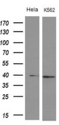 DMRT1 Antibody (OTI1G10), Novus Biologicals 0.1mL; Unlabeled:Antibodies,