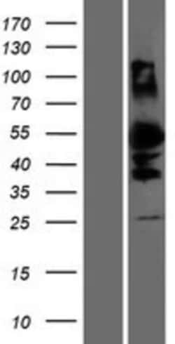 Novus Biologicals&trade;&nbsp;DMRTA1 Overexpression Lysate