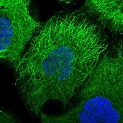 DMRTA2 Antibody, Novus Biologicals:Antibodies:Primary Antibodies