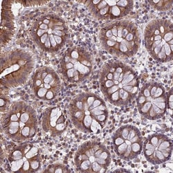 DMRTA2 Antibody, Novus Biologicals:Antibodies:Primary Antibodies