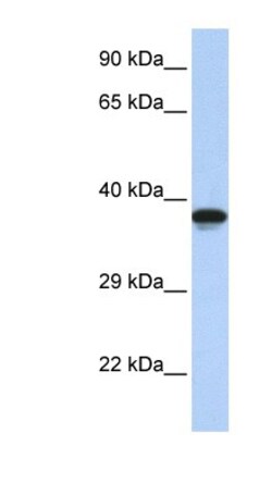 DMRTC2 Antibody, Novus Biologicals 100μL; Unlabeled:Antibodies, Polyclonal