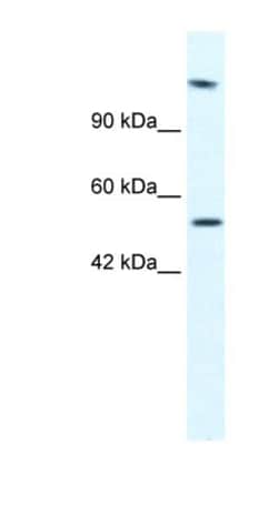 DNA helicase B Antibody, Novus Biologicals:Antibodies:Primary Antibodies