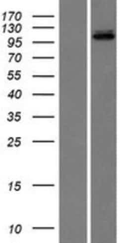 Novus Biologicals&trade;&nbsp;DNA Ligase III Overexpression Lysate