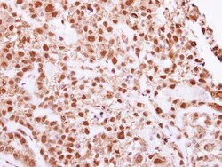 DNA Ligase IV Antibody, Novus Biologicals 0.1mL; Unlabeled:Antibodies,