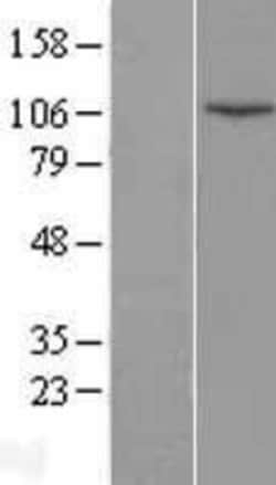 Novus Biologicals&trade;&nbsp;DNA Ligase IV Overexpression Lysate