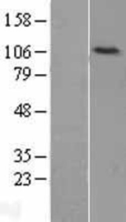 Novus Biologicals&trade;&nbsp;DNA Ligase IV Overexpression Lysate