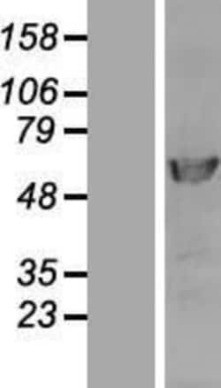 Novus Biologicals&trade;&nbsp;DNA polymerase delta p50 Overexpression Lysate