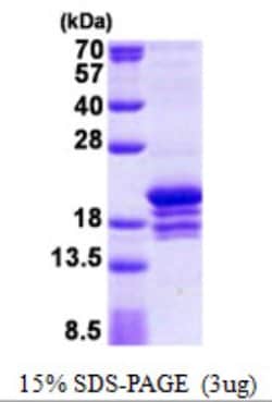 Novus Biologicals&trade;&nbsp;Recombinant Human DNA Polymerase epsilon subunit 3 His Protein