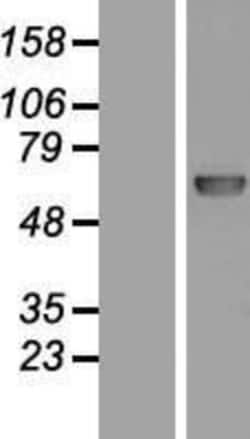 Novus Biologicals™ DNA Polymerase lambda Overexpression Lysate