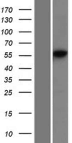 Novus Biologicals™ DNA Primase large subunit Overexpression Lysate