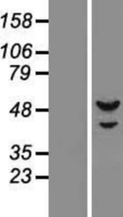 Novus Biologicals&trade;&nbsp;DNA Primase small subunit Overexpression Lysate