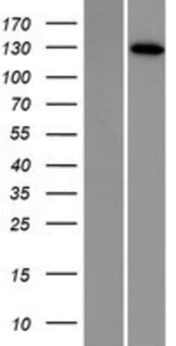 Novus Biologicals&trade;&nbsp;DNA2 Overexpression Lysate