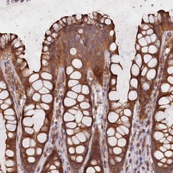 DNAH12 Antibody, Novus Biologicals 0.1mL; Unlabeled:Antibodies, Polyclonal