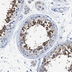 DNAI1 Antibody, Novus Biologicals 25 &mu;L; Unlabeled:Antibodies, Polyclonal