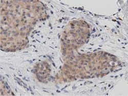 DNAJA2 Antibody (OTI3A10), Novus Biologicals 0.1mL; Unlabeled:Antibodies,